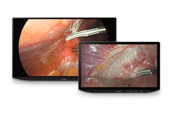 LMD-XH320MT 4K-3D/2D-Monitor für die Chirurgie - Sony Pro