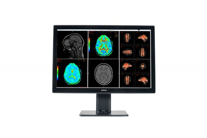 Barco Monitore - Medizinische Displaysysteme